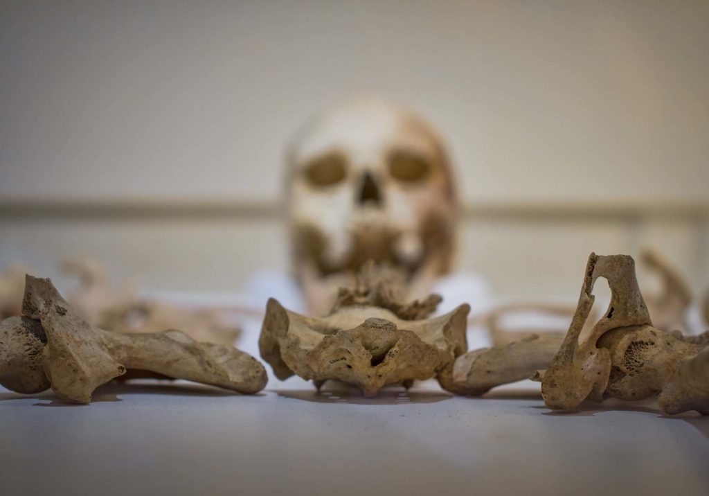 a photo of a skull and skeleton in a display case